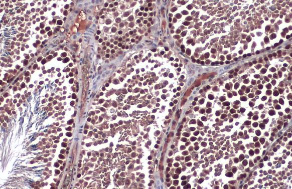 Rad51 antibody [N1C2] detects Rad51 protein at nucleus by immunohistochemical analysis.Sample: Paraffin-embedded mouse testis.Rad51 stained by Rad51 antibody [N1C2] (GRP460) diluted at 1:500.Antigen Retrieval: Citrate buffer, pH 6.0, 15 min