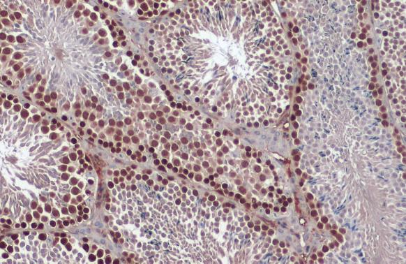 Rad51 antibody [N1C2] detects Rad51 protein at nucleus by immunohistochemical analysis.Sample: Paraffin-embedded mouse testis.Rad51 stained by Rad51 antibody [N1C2] (GRP460) diluted at 1:1000.Antigen Retrieval: Citrate buffer, pH 6.0, 15 min