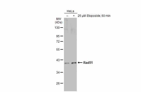 Untreated (â€“) and treated (+) HeLa whole cell extracts (30 μg) were separated by 10% SDS-PAGE, and the membrane was blotted with Rad51 antibody [N1C2] (GRP460) diluted at 1:1000. The HRP-conjugated anti-rabbit IgG antibody  was used to detect the pri