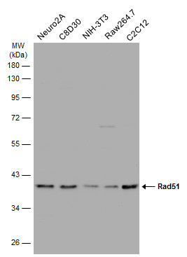 Various whole cell extracts (30 μg) were separated by 10% SDS-PAGE, and the membrane was blotted with Rad51 antibody [14B4] (GRP460) diluted at 1:500. The HRP-conjugated anti-rabbit IgG antibody  was used to detect the primary antibody.