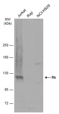 Various whole cell extracts (30 μg) were separated by 5% SDS-PAGE, and the membrane was blotted with Rb antibody (GRP463) diluted at 1:1000. The HRP-conjugated anti-rabbit IgG antibody  was used to detect the primary antibody.