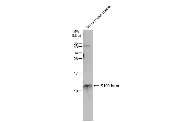 Mouse tissue extract (30 μg) was separated by 15% SDS-PAGE, and the membrane was blotted with S100 beta antibody (GRP610) diluted at 1:1500. The HRP-conjugated anti-rabbit IgG antibody  was used to detect the primary antibody.