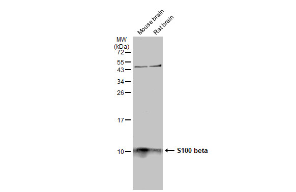 Various tissue extracts (50 μg) were separated by 15% SDS-PAGE, and the membrane was blotted with S100 beta antibody (GRP610) diluted at 1:1000. The HRP-conjugated anti-rabbit IgG antibody  was used to detect the primary antibody.