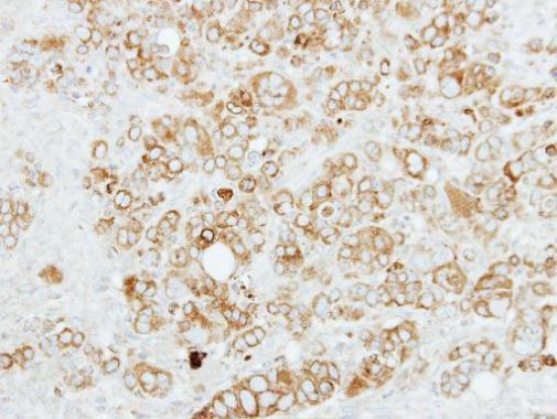 Immunohistochemical analysis of paraffin-embedded SW480 xenograft, using SIGMAR1(GRP600) antibody at 1:100 dilution.