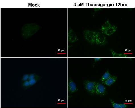 SQSTM1 antibody [N3C1], Internal detects SQSTM1 protein at autophagosome by immunofluorescent analysis.Samples: HepG2 cells treated with 3?M thapsigargin 12 hrs (rigtht) and mock (left) were fixed in ice-cold MeOH for 10 min, permeabilize with cooled acet