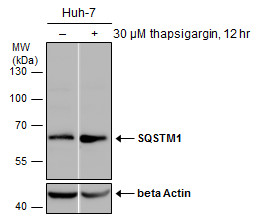 Untreated (â€“) and treated (+) Huh-7 whole cell extracts (30 μg) were separated by 10% SDS-PAGE, and the membrane was blotted with SQSTM1 antibody [N3C1], Internal (GRP467) diluted at 1:1000. The HRP-conjugated anti-rabbit IgG antibody  was used to de