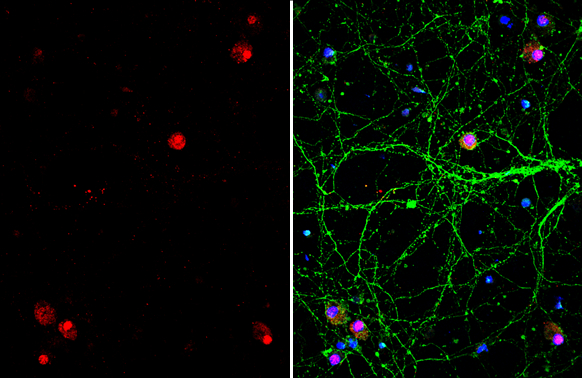 TDP43 antibody [GT225] detects TDP43 protein immunofluorescent analysis.Sample: DIV10 rat E18 primary cortical neuron cells were fixed in 4% paraformaldehyde at RT for 15 min.Green: Nestin stained by Nestin antibody (GRP624) diluted at 1:500.Red: TDP43 st