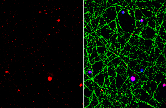 TDP43 antibody [GT225] detects TDP43 protein by immunofluorescent analysis.Sample: DIV10 rat E18 primary cortical neuron cells were fixed in 4% paraformaldehyde at RT for 15 min.Green: Nestin stained by Nestin antibody (GRP624) diluted at 1:500.Red: TDP43
