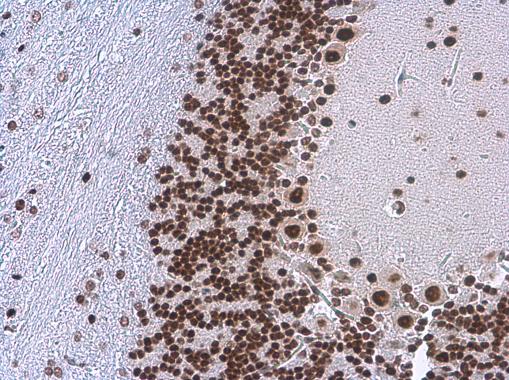 TDP43 antibody [GT225] detects TDP43 protein at nucleus in mouse brain by immunohistochemical analysis. Sample: Paraffin-embedded mouse brain. TDP43 antibody [GT225] (GRP624) diluted at 1:200.