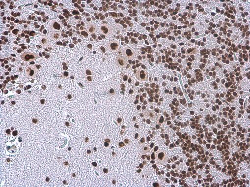 TDP43 antibody [GT225] detects TDP43 protein at nucleus in rat brain by immunohistochemical analysis. Sample: Paraffin-embedded rat brain. TDP43 antibody [GT225] (GRP624) diluted at 1:200.