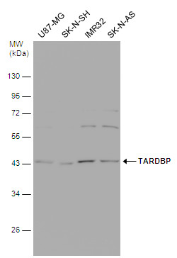 Various whole cell extracts (30 μg) were separated by 10% SDS-PAGE, and the membrane was blotted with TARDBP antibody [GT225] (GRP624) diluted at 1:500.