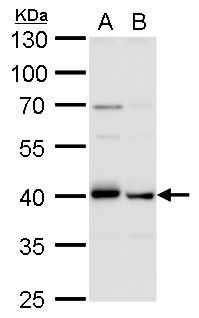 TARDBP antibody [GT225] detects TARDBP  protein by western blot analysis.A. 30 μg PC-12 whole cell lysate/extractB. 30 μg Rat2 whole cell lysate/extract10 % SDS-PAGETARDBP antibody [GT225] (GRP624) dilution: 1:1000