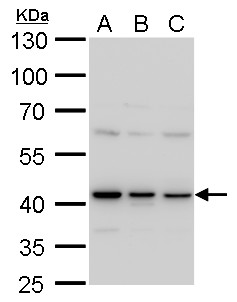 TARDBP antibody [GT225] detects TARDBP protein by western blot analysis.A. 30 μg 293T whole cell lysate/extract B. 30 μg A431 whole cell lysate/extract C. 30 μg HeLa whole cell lysate/extract10 % SDS-PAGETARDBP antibody [GT225] (GRP624) dilution: