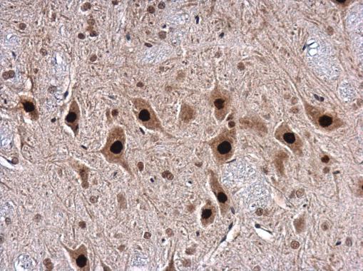 TARDBP antibody detects TARDBP protein at nucleus in mouse brain by immunohistochemical analysis. Sample: Paraffin-embedded mouse brain. TARDBP antibody (GRP548) diluted at 1:500.