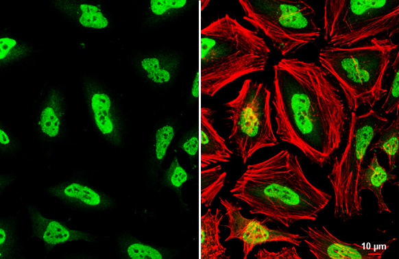 TDP43 antibody detects TDP43 protein at nucleus by immunofluorescent analysis.Sample: HeLa cells were fixed in 4% paraformaldehyde at RT for 15 min.Green: TDP43 stained by TDP43 antibody (GRP593) diluted at 1:500.Red: phalloidin, a cytoskeleton marker, di