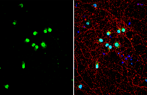TDP43 antibody detects TDP43 protein by immunofluorescent analysis.Sample: DIV10 rat E18 primary cortical neuron cells were fixed in 4% paraformaldehyde at RT for 15 min.Green: TDP43 stained by TDP43 antibody (GRP593) diluted at 1:500.Red: Tau, stained by