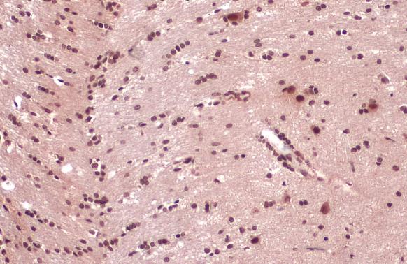 TDP43 antibody detects TDP43 protein at cytoplasm and nucleus by immunohistochemical analysis.Sample: Paraffin-embedded rat brain.TDP43 stained by TDP43 antibody (GRP593) diluted at 1:2000.Antigen Retrieval: Citrate buffer, pH 6.0, 15 min