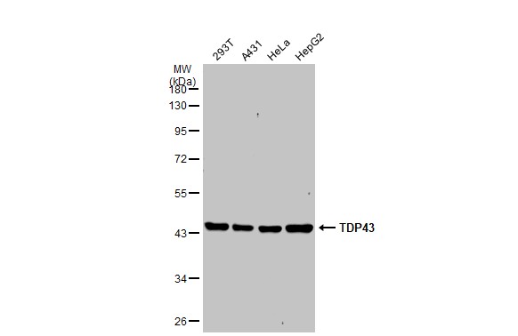 Various whole cell extracts (30 μg) were separated by 10% SDS-PAGE, and the membrane was blotted with TDP43 antibody (GRP593) diluted at 1:1000. The HRP-conjugated anti-rabbit IgG antibody  was used to detect the primary antibody.