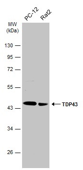 Various whole cell extracts (30 μg) were separated by 10% SDS-PAGE, and the membrane was blotted with TDP43 antibody (GRP593) diluted at 1:2000. The HRP-conjugated anti-rabbit IgG antibody  was used to detect the primary antibody.