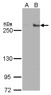 TET1 antibody detects TET1 protein by Western blot analysis.A. 30 ?g 293T whole cell lysate/extractB. 30 ?g whole cell lysate/extract of DDDDK-human TET1-transfected 293T cells5 % SDS-PAGETET1 antibody (GRP530) dilution: 1:500