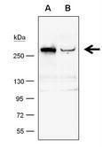 TET1 antibody [GT1462] detects TET1 protein by western blot analysis.A. 50 μg whole cell lysate/extract from 293T cells transfected with scramble siRNA B. 50 μg whole cell lysate/extract from TET1-knockdowned 293T cells6% SDS-PAGETET1 antibody [GT14