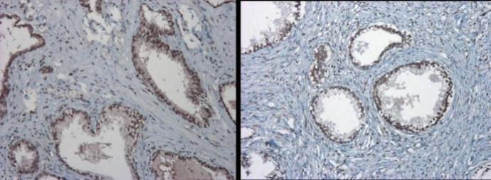 TET1 antibody [N3C1] detects TET1 protein at nucleus on Human normal prostate tissue by immunohistochemical analysis. Sample: Paraffin-embedded Human normal prostate tissue. TET1 antibody [N3C1] (GRP515) dilution: 1:1000.