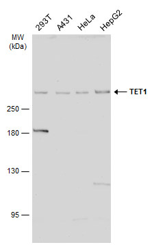 Various whole cell extracts (30 μg) were separated by 5% SDS-PAGE, and the membrane was blotted with TET1 antibody [N3C1] (GRP515) diluted at 1:2000. The HRP-conjugated anti-rabbit IgG antibody  was used to detect the primary antibody.