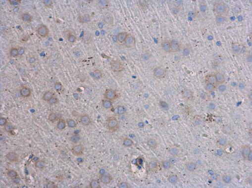 TNF alpha antibody detects TNF alpha protein at cell membrane in rat brain by immunohistochemical analysis. Sample: Paraffin-embedded rat brain. TNF alpha antibody (GRP497) diluted at 1:400.