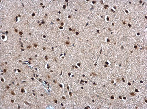Twist1/2 antibody detects Twist1/2 protein at nucleus on rat fore brain by immunohistochemical analysis. Sample: Paraffin-embedded rat fore brain. Twist1/2 antibody (GRP518) dilution: 1:500.