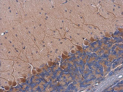 Tyrosine Hydroxylase antibody [N1C1] detects Tyrosine Hydroxylase protein at cell membrane and cytoplasm by immunohistochemical analysis.Sample: Paraffin-embedded mouse brain.Tyrosine Hydroxylase stained by Tyrosine Hydroxylase antibody [N1C1] (GRP562) di