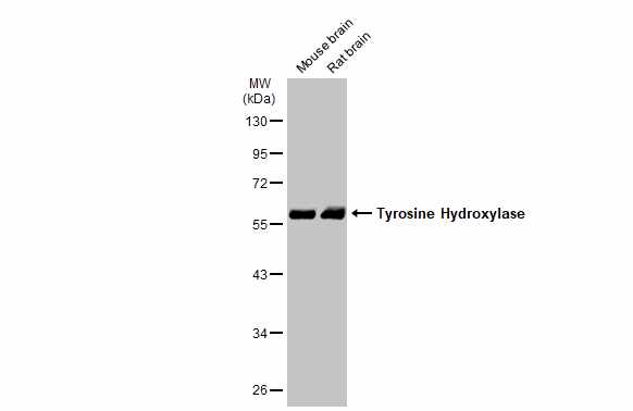 Various tissue extracts (50 μg) were separated by 10% SDS-PAGE, and the membrane was blotted with Tyrosine Hydroxylase antibody [N1C1] (GRP562) diluted at 1:1000. The HRP-conjugated anti-rabbit IgG antibody  was used to detect the primary antibody.