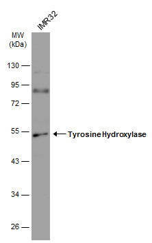 Whole cell extract (30 μg) was separated by 10% SDS-PAGE, and the membrane was blotted with Tyrosine Hydroxylase antibody [N1C1] (GRP562) diluted at 1:1000. The HRP-conjugated anti-rabbit IgG antibody  was used to detect the primary antibody.