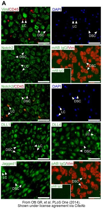The IHC-P analysis of Vimentin antibody was published by Otti GR and colleagues in the journal PLoS One in 2014.PMID: 25397403