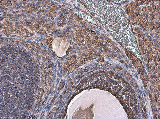 Vimentin antibody detects Vimentin protein at cell membrane and cytoplasm in rat ovary by immunohistochemical analysis. Sample: Paraffin-embedded rat ovary. Vimentin antibody (GRP465) diluted at 1:500.