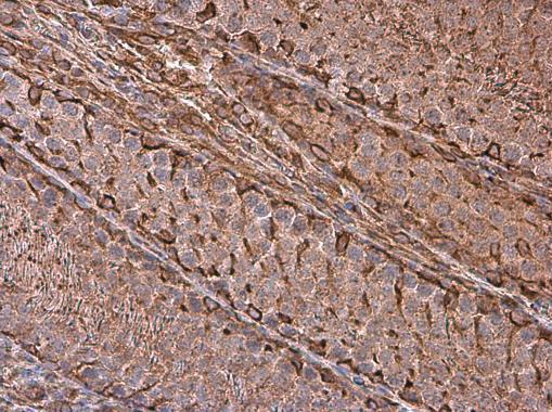 Vimentin antibody detects Vimentin protein at cell membrane and cytoplasm in rat testis by immunohistochemical analysis. Sample: Paraffin-embedded rat testis. Vimentin antibody (GRP465) diluted at 1:500.