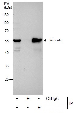 Immunoprecipitation of Vimentin protein from HeLa whole cell extracts using 5 ?g of Vimentin antibody (GRP465).Western blot analysis was performed using Vimentin antibody (GRP465).EasyBlot anti-Rabbit IgG  was used as a secondary reagent.