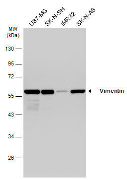 Various whole cell extracts (30 μg) were separated by 10% SDS-PAGE, and the membrane was blotted with Vimentin antibody (GRP465) diluted at 1:50000. The HRP-conjugated anti-rabbit IgG antibody  was used to detect the primary antibody.