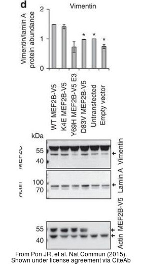 The WB analysis of Vimentin antibody was published by Pon JR and colleagues in the journal Nat Commun in 2015.PMID: 26245647