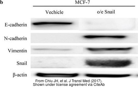 The WB analysis of Vimentin antibody was published by Chiu JH and colleagues in the journal J Transl Med in 2017.PMID: 28472954