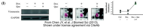 The WB analysis of Vimentin antibody was published by Chen JY and colleagues in the journal J Biomed Sci in 2013.PMID: 24359494