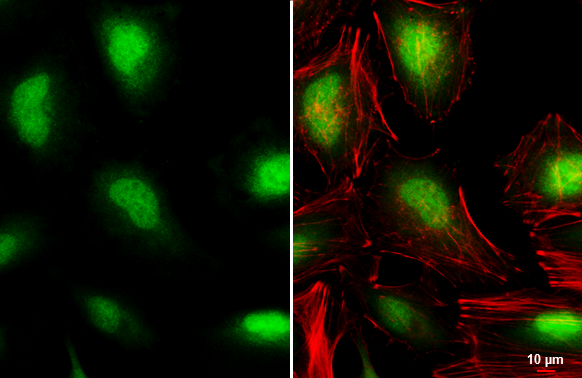 Von Hippel Lindau antibody detects Von Hippel Lindau protein at cytoplasm and nucleus by immunofluorescent analysis.Sample: HeLa cells were fixed in 4% paraformaldehyde at RT for 15 min.Green: Von Hippel Lindau stained by Von Hippel Lindau antibody (GRP47