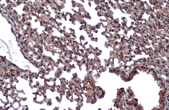 Von Hippel Lindau antibody detects Von Hippel Lindau protein at nucleus by immunohistochemical analysis.Sample: Paraffin-embedded mouse lung.Von Hippel Lindau stained by Von Hippel Lindau antibody (GRP470) diluted at 1:500.Antigen Retrieval: Citrate buffe
