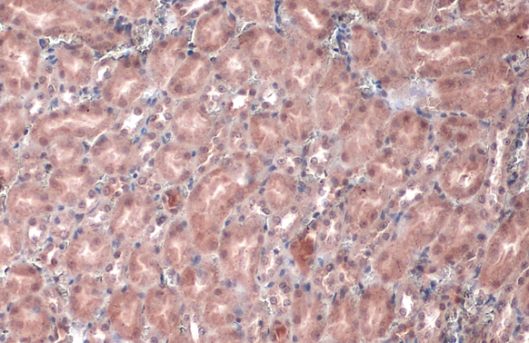 Von Hippel Lindau antibody detects Von Hippel Lindau protein at cytoplasm by immunohistochemical analysis.Sample: Paraffin-embedded mouse kidney.Von Hippel Lindau stained by Von Hippel Lindau antibody (GRP470) diluted at 1:500.Antigen Retrieval: Citrate b