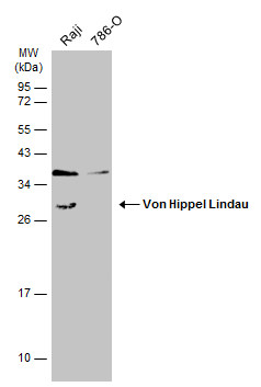 Various whole cell extracts (30 μg) were separated by 12% SDS-PAGE, and the membrane was blotted with Von Hippel Lindau antibody (GRP470) diluted at 1:1000. The HRP-conjugated anti-rabbit IgG antibody  was used to detect the primary antibody.