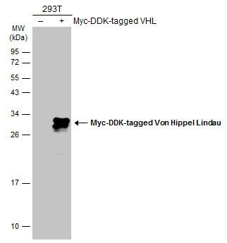 Non-transfected (â€“) and transfected (+) 293T whole cell extracts (30 μg) were separated by 12% SDS-PAGE, and the membrane was blotted with Von Hippel Lindau antibody (GRP470) diluted at 1:5000. The HRP-conjugated anti-rabbit IgG antibody  was used to