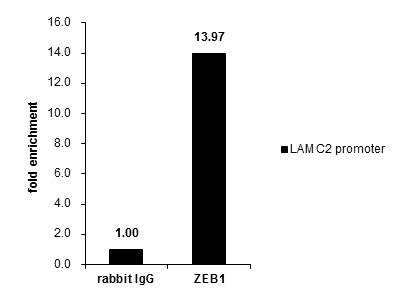 Cross-linked ChIP was performed with HeLa chromatin extract and 5 ?g of either control rabbit IgG or anti-ZEB1 antibody. The precipitated DNA was detected by PCR with primer set targeting to LAMC2 promotor.