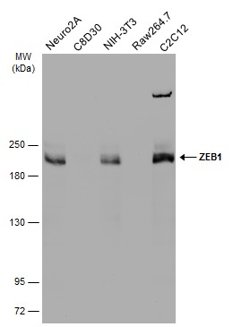 Various whole cell extracts (30 μg) were separated by 5% SDS-PAGE, and the membrane was blotted with ZEB1 antibody (GRP490) diluted at 1:1000. The HRP-conjugated anti-rabbit IgG antibody  was used to detect the primary antibody.
